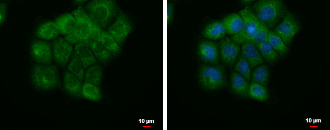 EEFSEC Antibody in Immunocytochemistry (ICC/IF)