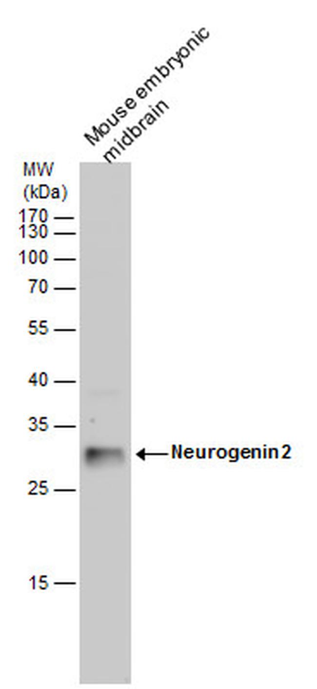 Neurogenin 2 Antibody in Western Blot (WB)