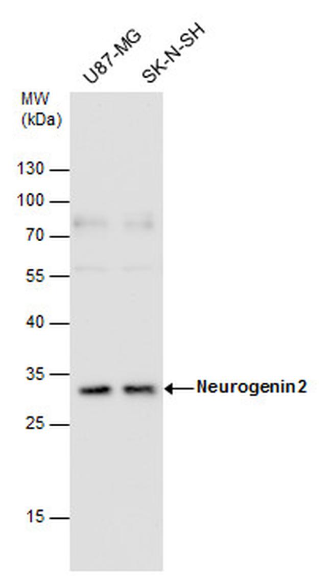 Neurogenin 2 Antibody in Western Blot (WB)