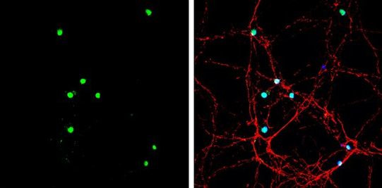 Neurogenin 2 Antibody in Immunocytochemistry (ICC/IF)