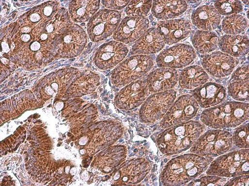 MFN1 Antibody in Immunohistochemistry (Paraffin) (IHC (P))