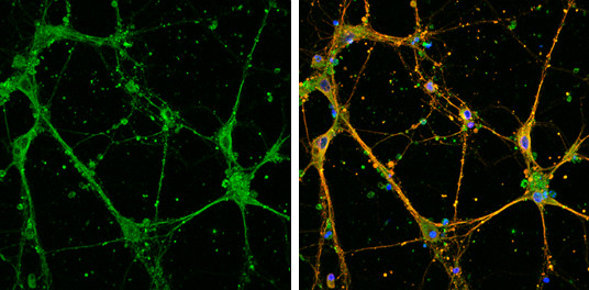 EFHD2 Antibody in Immunocytochemistry (ICC/IF)