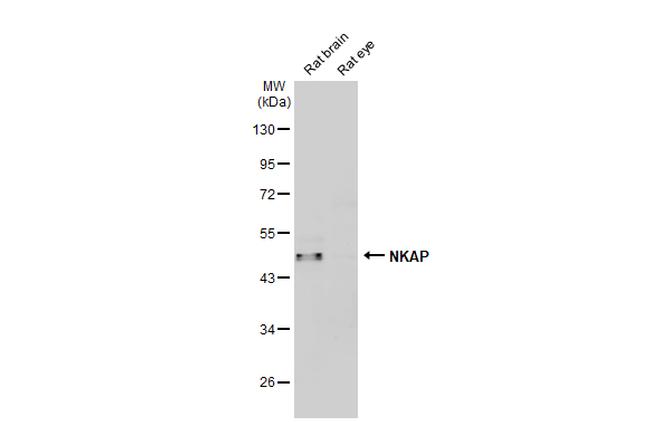 NKAP Antibody in Western Blot (WB)