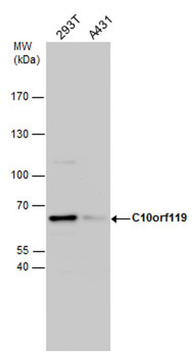 MCMBP Antibody in Western Blot (WB)