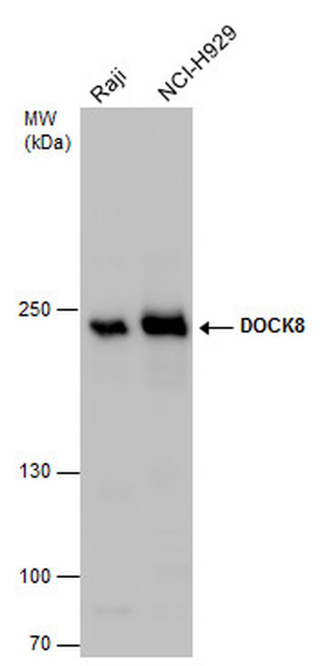 DOCK8 Antibody in Western Blot (WB)