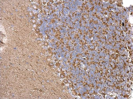 CHRDL1 Antibody in Immunohistochemistry (Paraffin) (IHC (P))