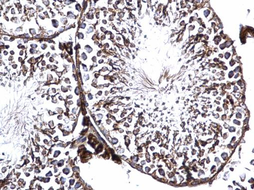 GFM2 Antibody in Immunohistochemistry (Paraffin) (IHC (P))