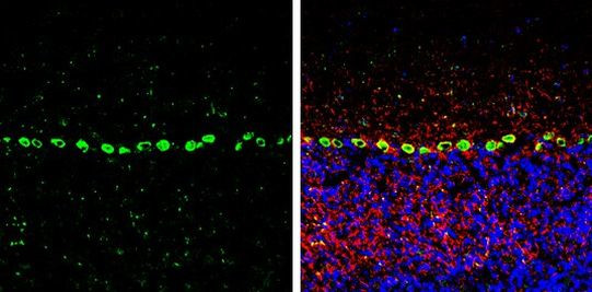 PSRC1 Antibody in Immunohistochemistry (Frozen) (IHC (F))