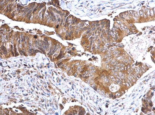 TSLP Antibody in Immunohistochemistry (Paraffin) (IHC (P))