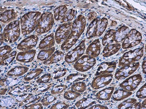 BBS4 Antibody in Immunohistochemistry (Paraffin) (IHC (P))