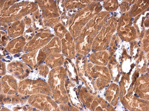 IRAK1BP1 Antibody in Immunohistochemistry (Paraffin) (IHC (P))