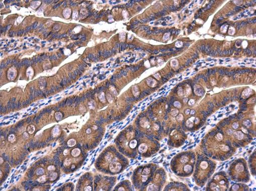 IRAK1BP1 Antibody in Immunohistochemistry (Paraffin) (IHC (P))