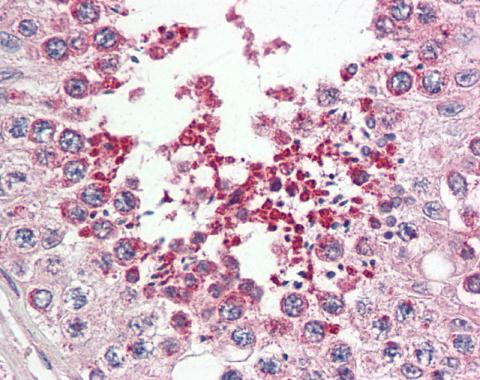 IRAK1BP1 Antibody in Immunohistochemistry (Paraffin) (IHC (P))