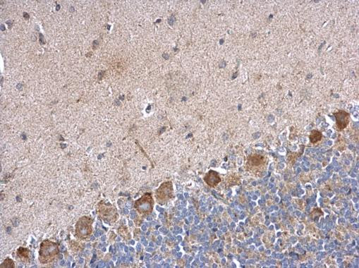 PABPC5 Antibody in Immunohistochemistry (Paraffin) (IHC (P))