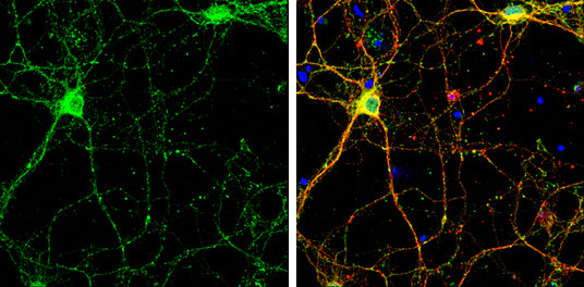 SHANK2 Antibody in Immunocytochemistry (ICC/IF)