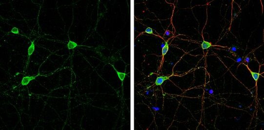 SAPAP1 Antibody in Immunocytochemistry (ICC/IF)