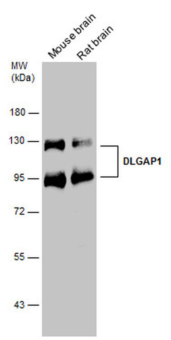 SAPAP1 Antibody in Western Blot (WB)