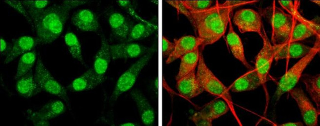 NEIL2 Antibody in Immunocytochemistry (ICC/IF)