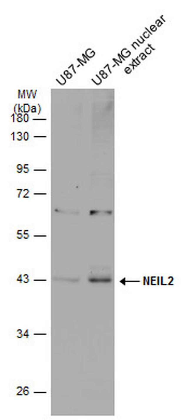 NEIL2 Antibody in Western Blot (WB)