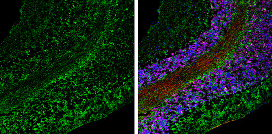 ABAT Antibody in Immunohistochemistry (Frozen) (IHC (F))