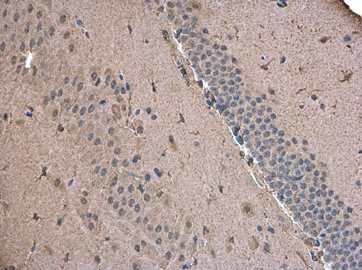 ABAT Antibody in Immunohistochemistry (Paraffin) (IHC (P))