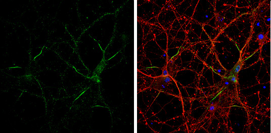 Neurofascin Antibody in Immunocytochemistry (ICC/IF)