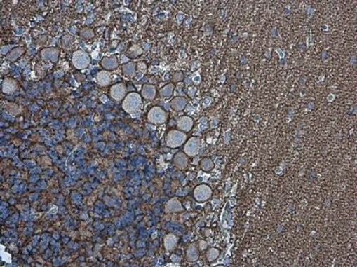 Neurofascin Antibody in Immunohistochemistry (Paraffin) (IHC (P))