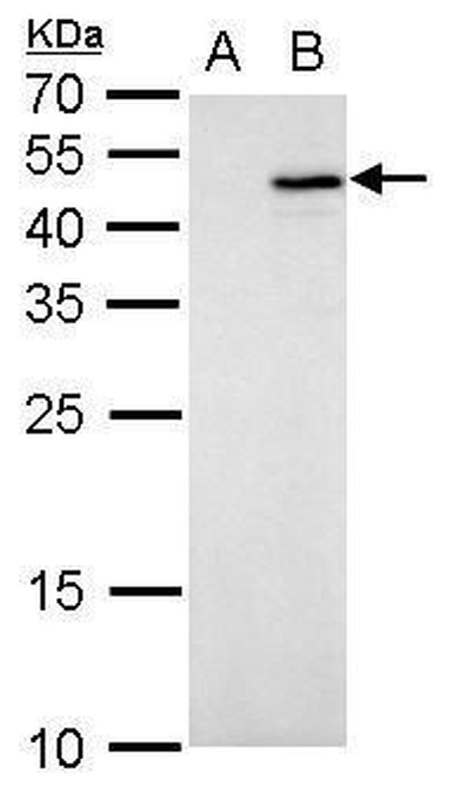 IL-28B Antibody in Western Blot (WB)