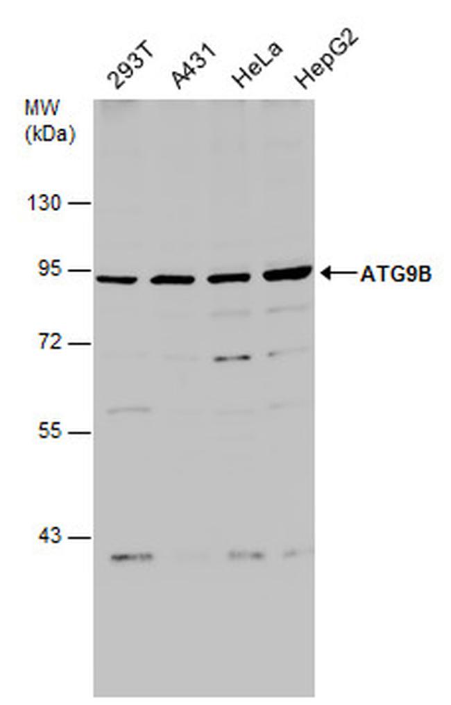 ATG9B Antibody in Western Blot (WB)