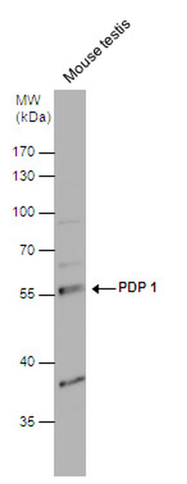 PDP1 Antibody in Western Blot (WB)