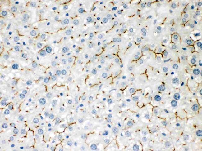 BSEP Antibody in Immunohistochemistry (Paraffin) (IHC (P))