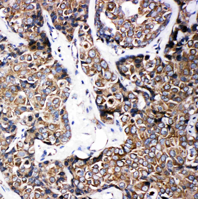 ABCB6 Antibody in Immunohistochemistry (Paraffin) (IHC (P))