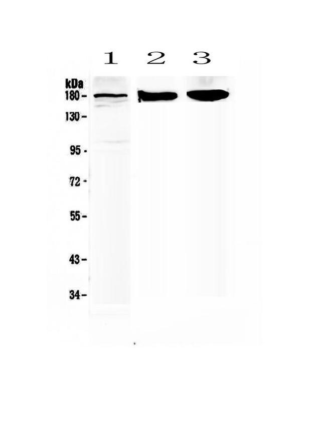 SUR1 Antibody in Western Blot (WB)