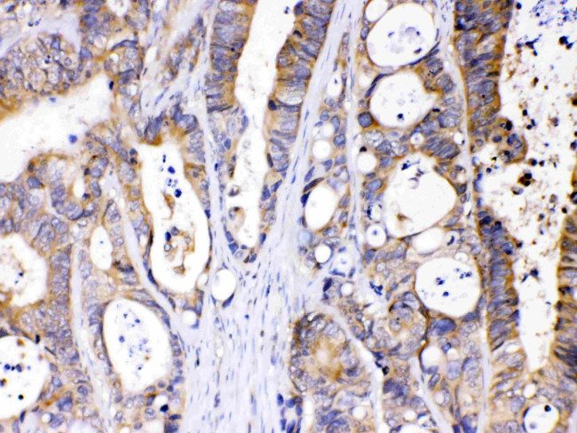 ABHD5 Antibody in Immunohistochemistry (Paraffin) (IHC (P))