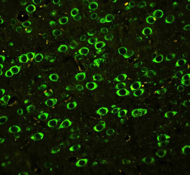 ABI1 Antibody in Immunohistochemistry (Paraffin) (IHC (P))