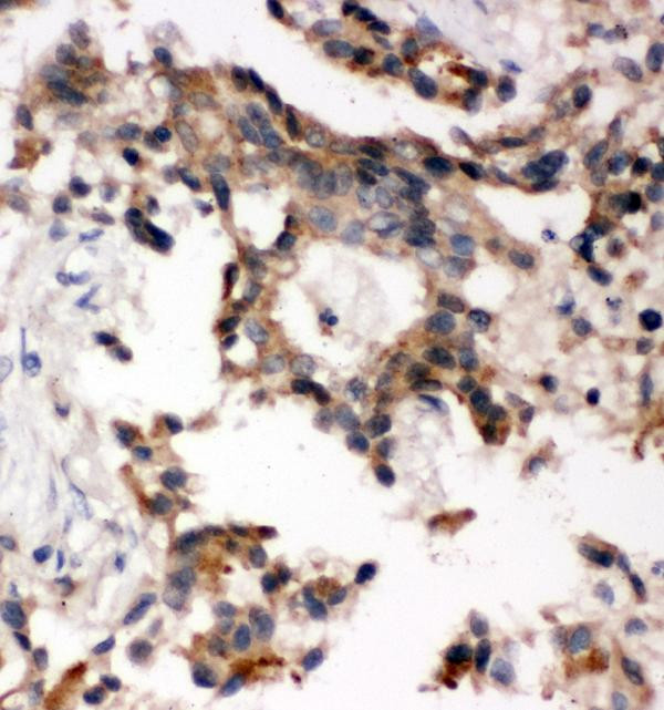 ABI1 Antibody in Immunohistochemistry (Paraffin) (IHC (P))