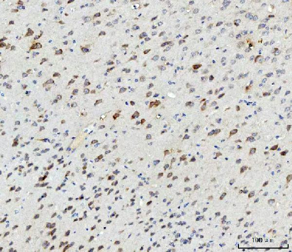 ABI1 Antibody in Immunohistochemistry (Paraffin) (IHC (P))