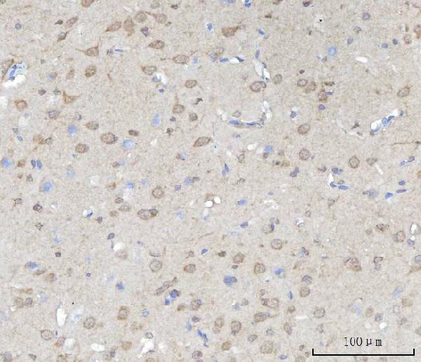 ABI1 Antibody in Immunohistochemistry (Paraffin) (IHC (P))