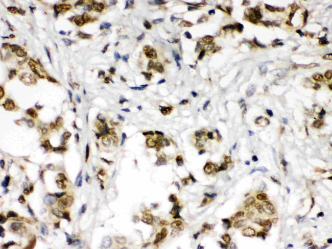 ABR Antibody in Immunohistochemistry (Paraffin) (IHC (P))