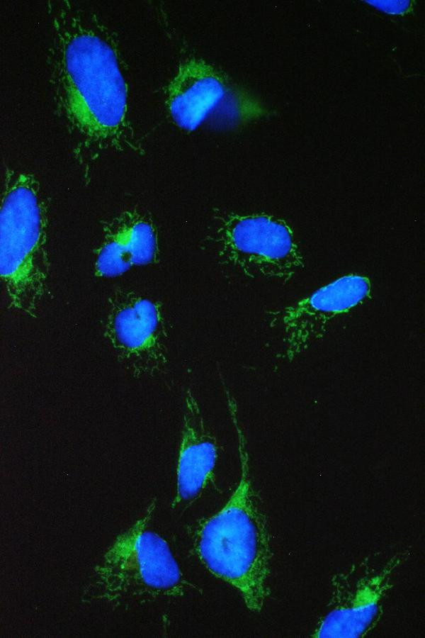 ACAA2 Antibody in Immunocytochemistry (ICC/IF)