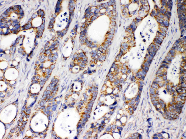 ACAA2 Antibody in Immunohistochemistry (Paraffin) (IHC (P))