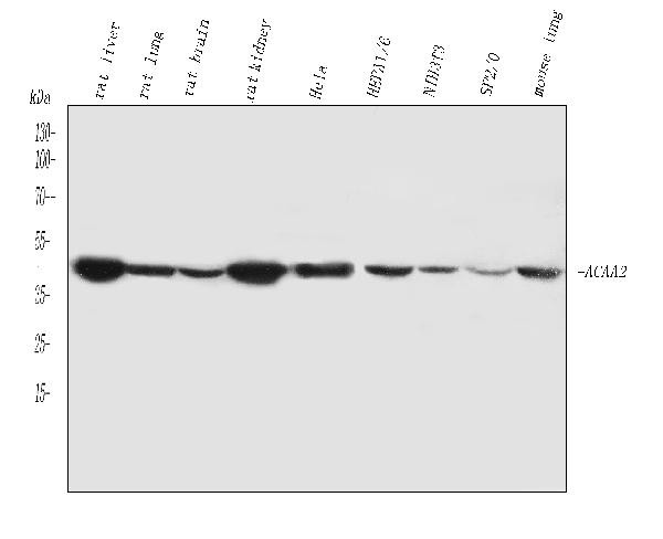 ACAA2 Antibody in Western Blot (WB)