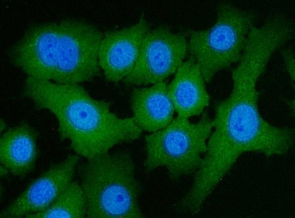 ATP Citrate Lyase Antibody in Immunocytochemistry (ICC/IF)