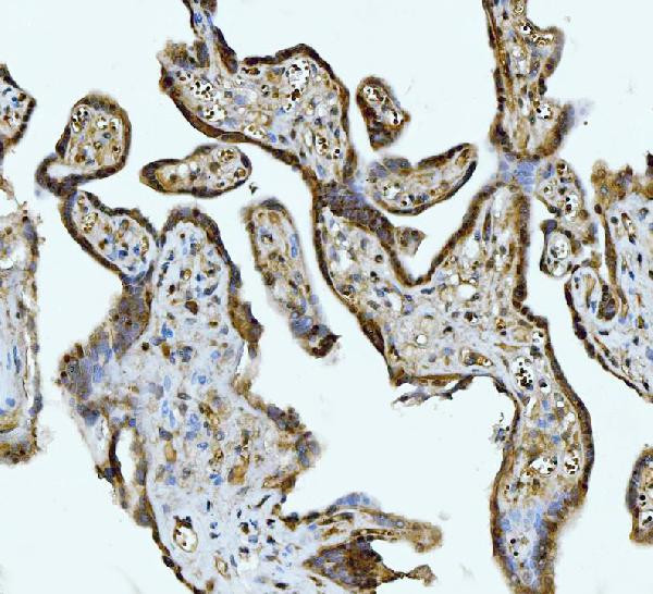 ATP Citrate Lyase Antibody in Immunohistochemistry (Paraffin) (IHC (P))