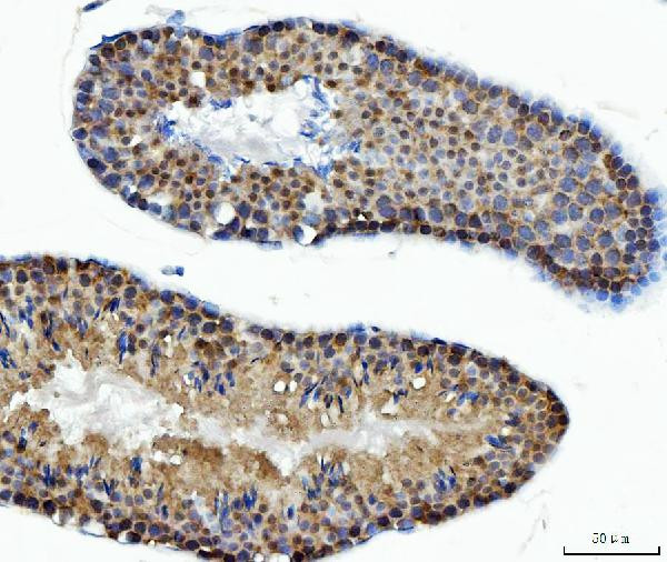 ATP Citrate Lyase Antibody in Immunohistochemistry (Paraffin) (IHC (P))