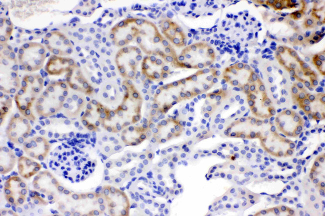 ACSL1 Antibody in Immunohistochemistry (Paraffin) (IHC (P))