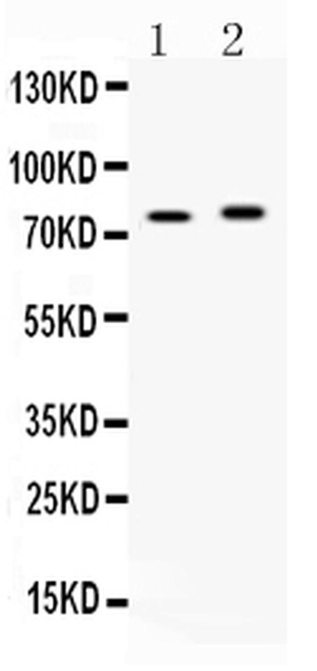 ACSL5 Antibody in Western Blot (WB)