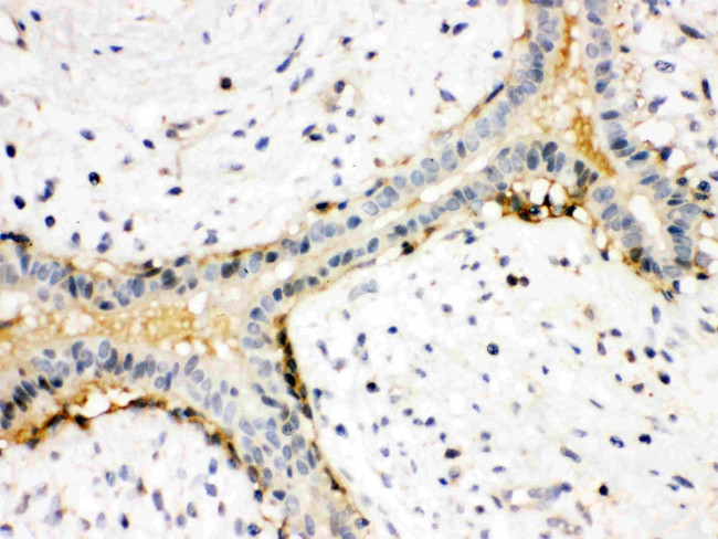 Actin Antibody in Immunohistochemistry (Paraffin) (IHC (P))