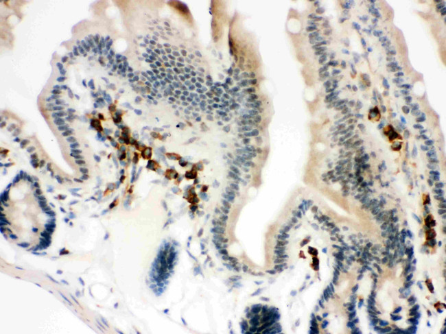 Actin Antibody in Immunohistochemistry (Paraffin) (IHC (P))