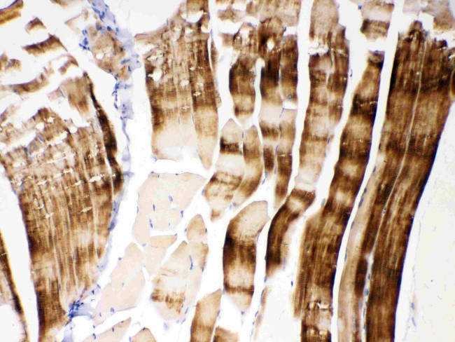 alpha Actinin 3 Antibody in Immunohistochemistry (Paraffin) (IHC (P))